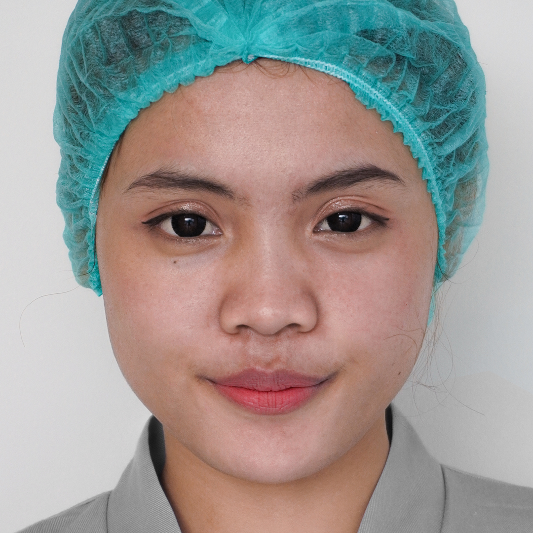 After Acne Clear Peel