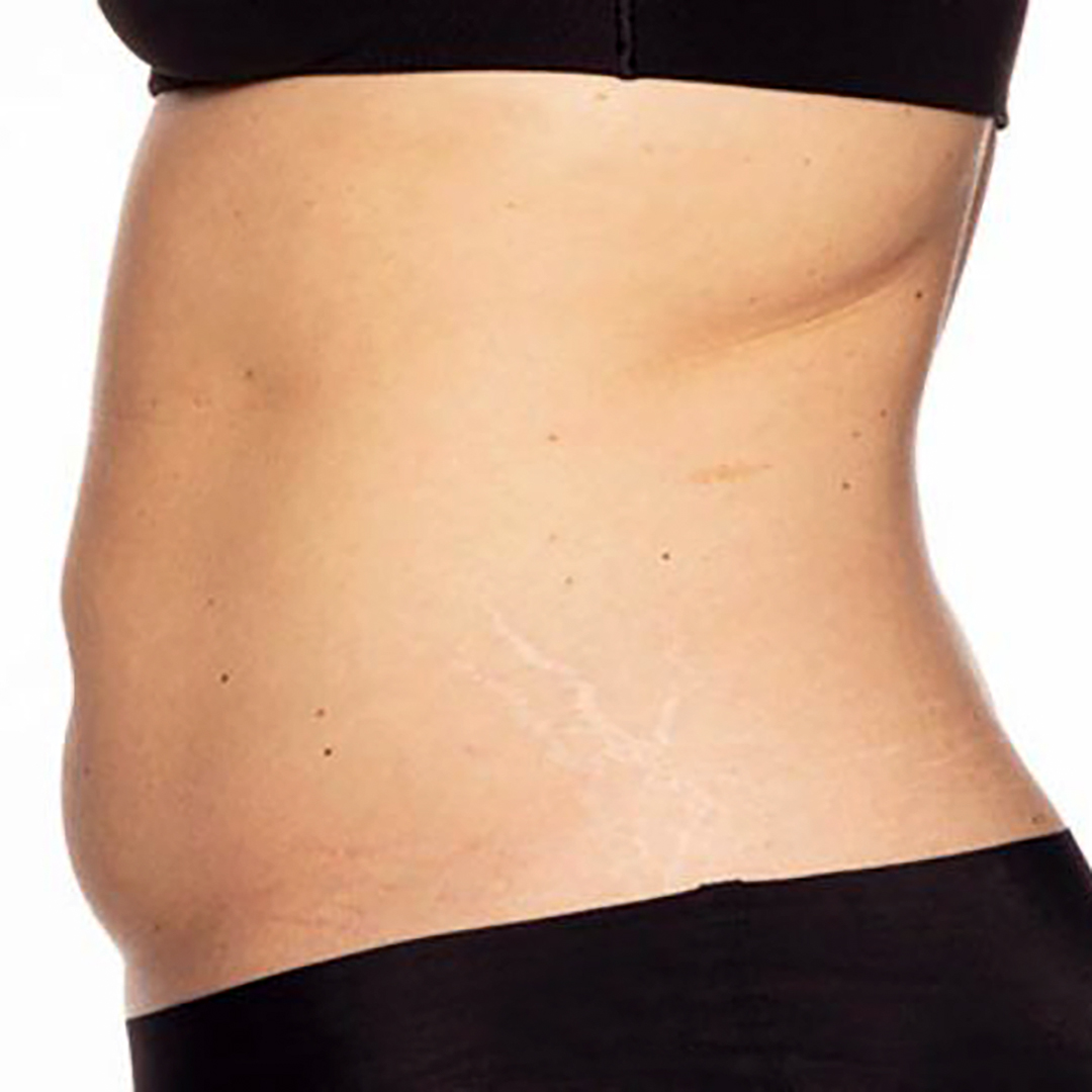 After Hollywood Body Toning