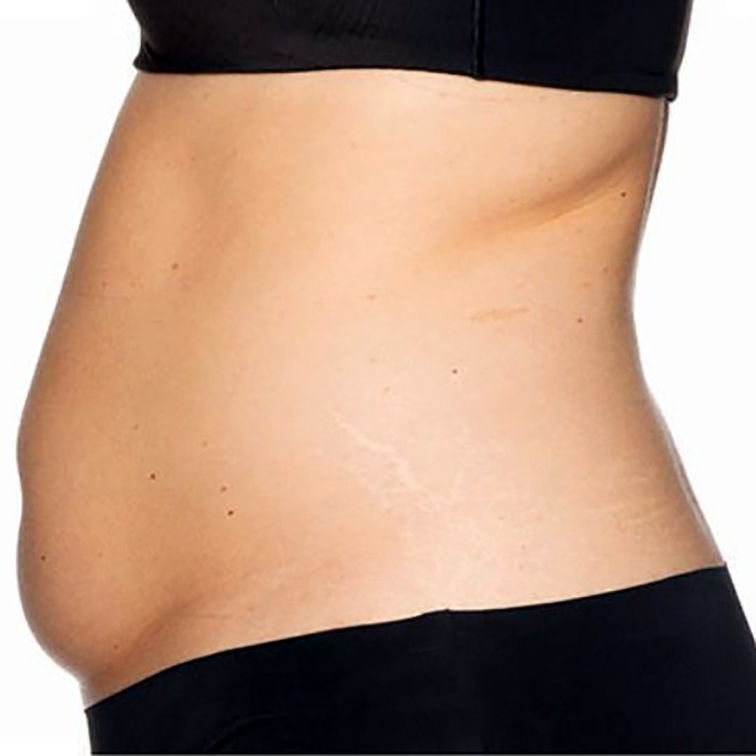 Before Hollywood Body Toning