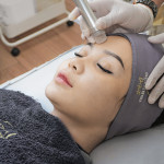 Dermabrasion