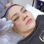 RF Eye Bag