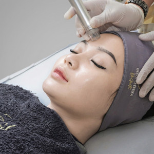 Dermabrasion