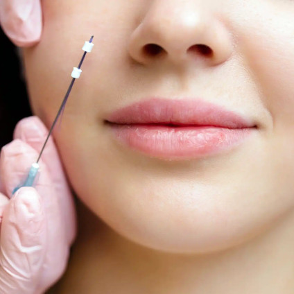 Nose Threadlift Cuping