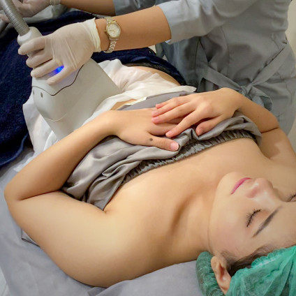 Cryo 2.0