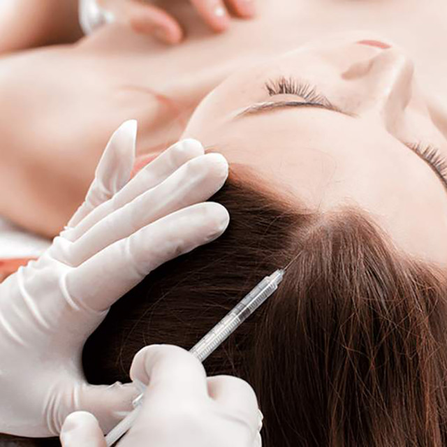 Micrografting hair Regeneration