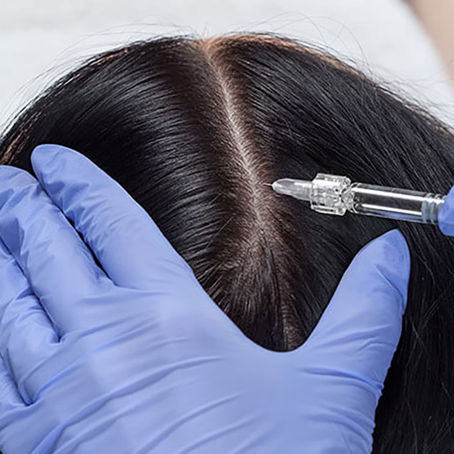Hair Filler