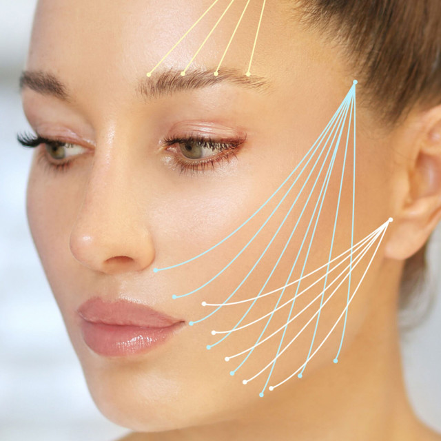 Gold Threadlift